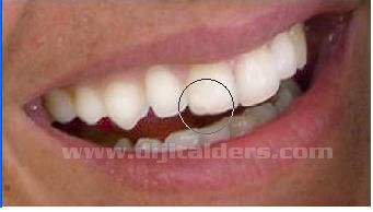 Aydınlatma aracıDodge tool